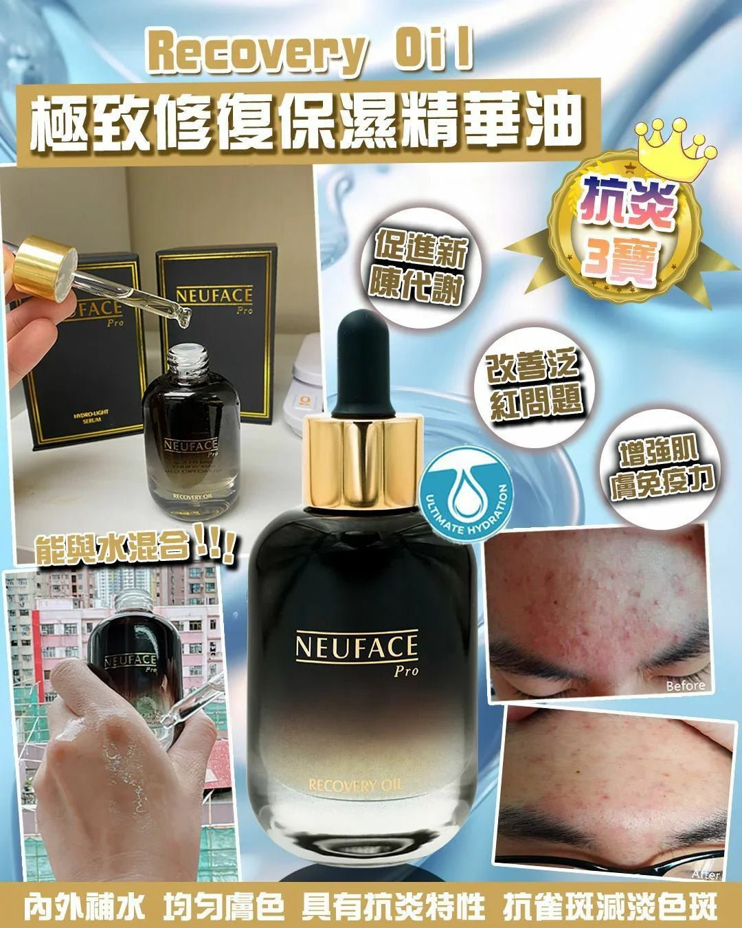 Neuface Pro Recovery Oil - HLY &amp; CHOCCICO