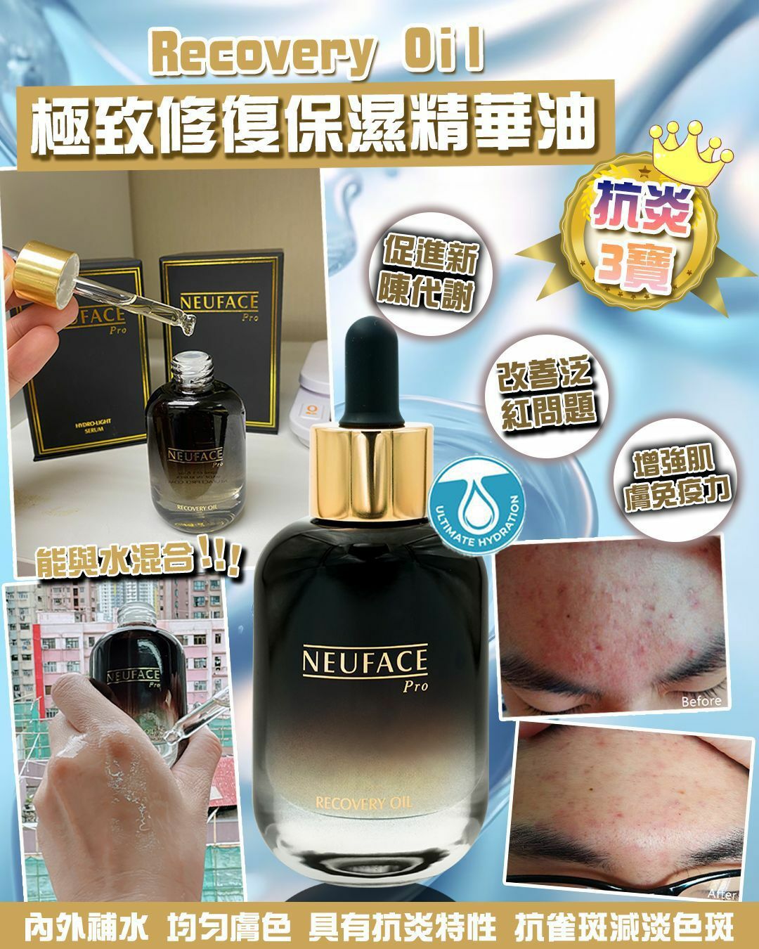 Neuface Pro Recovery Oil HLY & CHOCCICO