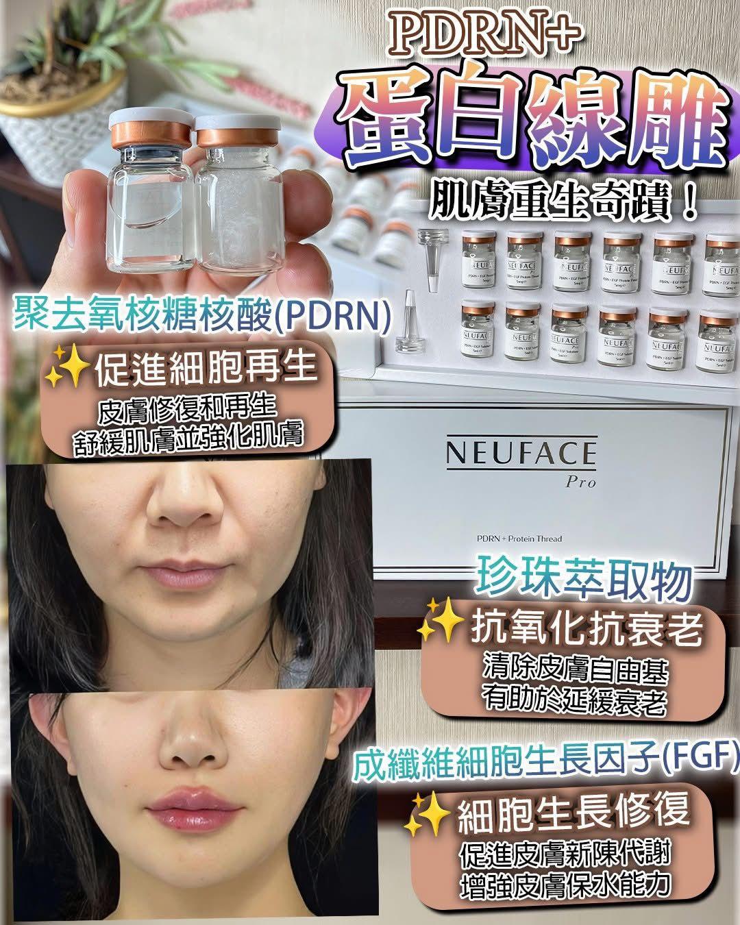 Neuface pro蛋白線雕+PDRN 生長因子 - HLY &amp; CHOCCICO