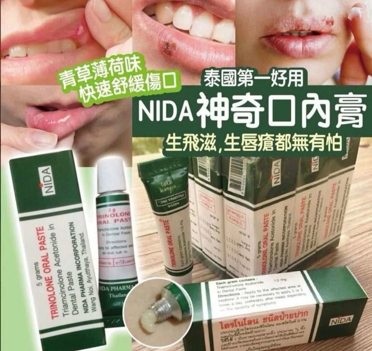 泰國NIDA神奇痱滋膏5g✨ - HLY &amp; CHOCCICO
