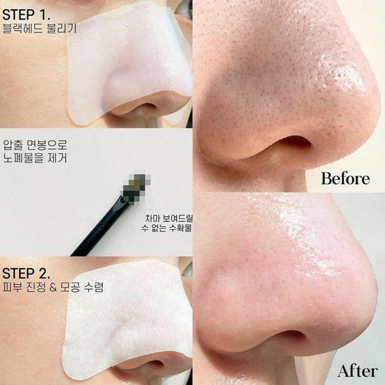 韓國Olive Young No.1  ilso溫和深層清潔黑頭鼻貼