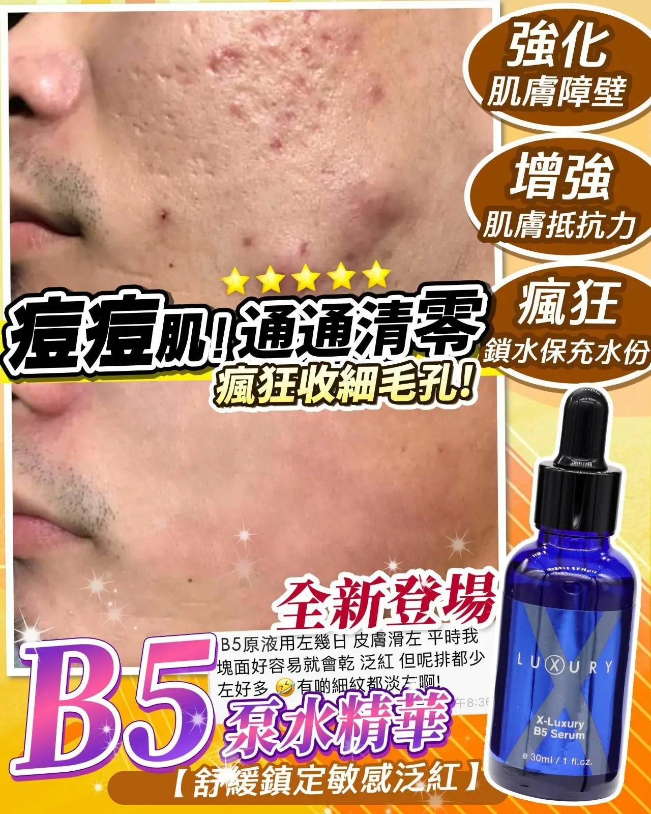 【一口價$280起/支】XLuxury肌皇 超強B5泵水精華 30ml