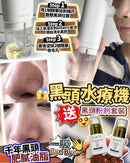 Anlan黑頭水療機 送黑頭套裝 FM
