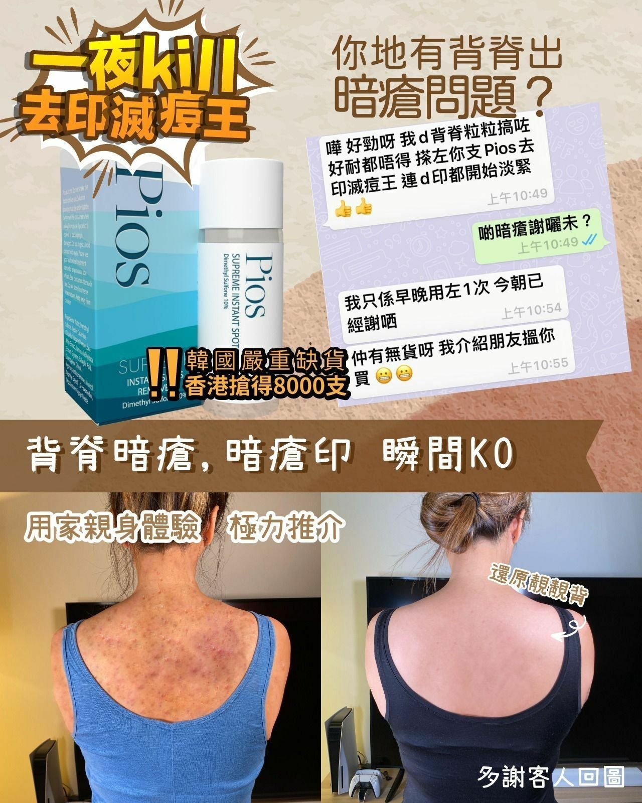 PIOS瞬時去痘淨膚精華 ｜一夜KILL 去印滅痘王 | HLY & CHOCCICO