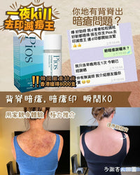 PIOS瞬時去痘淨膚精華 ｜一夜KILL 去印滅痘王 | HLY & CHOCCICO