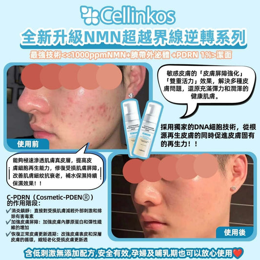 Cellinkos <1000ppmNMN+臍帶外泌體 +PDRN>潔面