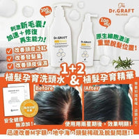 韓國🇰🇷Dr.GRAFT 植髮皇 孕育洗頭水300ml/ 孕育精華100ml Ladies Mart