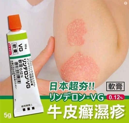 【一口價$60/支】日本VG濕疹軟膏 5g |濕疹|皮膚過敏|黑皮症|股癬|苔蘚|皮膚炎|癢疹|膿皰|紅斑|