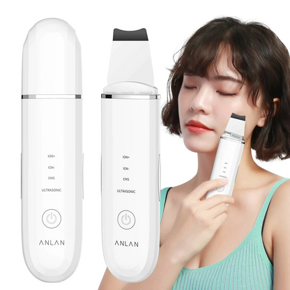 【一口價$328/部】🇯🇵日本ANLAN 超聲波剷皮機