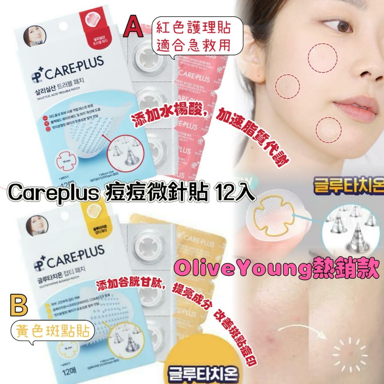 韓國Olive Young 熱銷款 Careplus 痘痘微針貼 12入