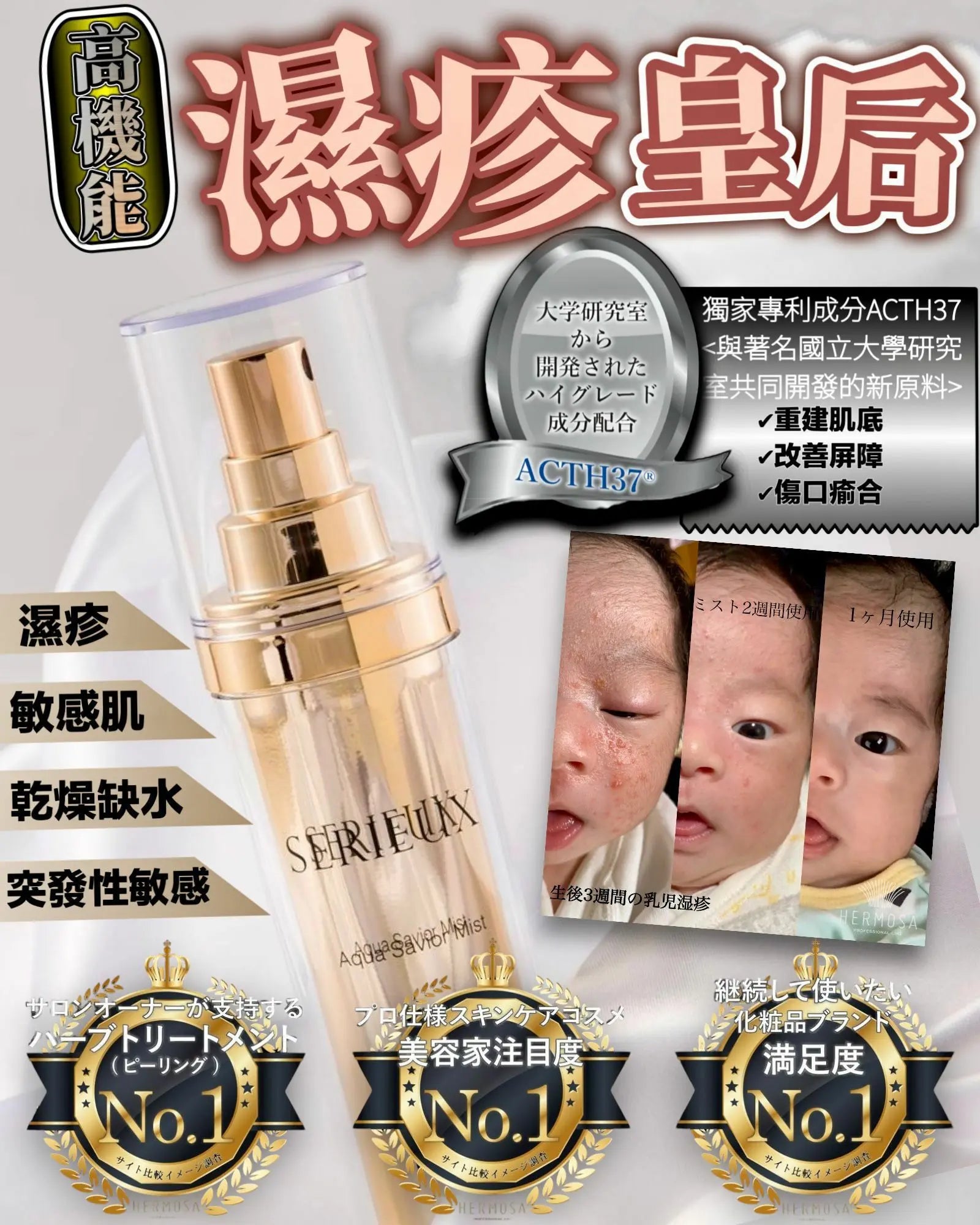 Serieux濕疹皇后