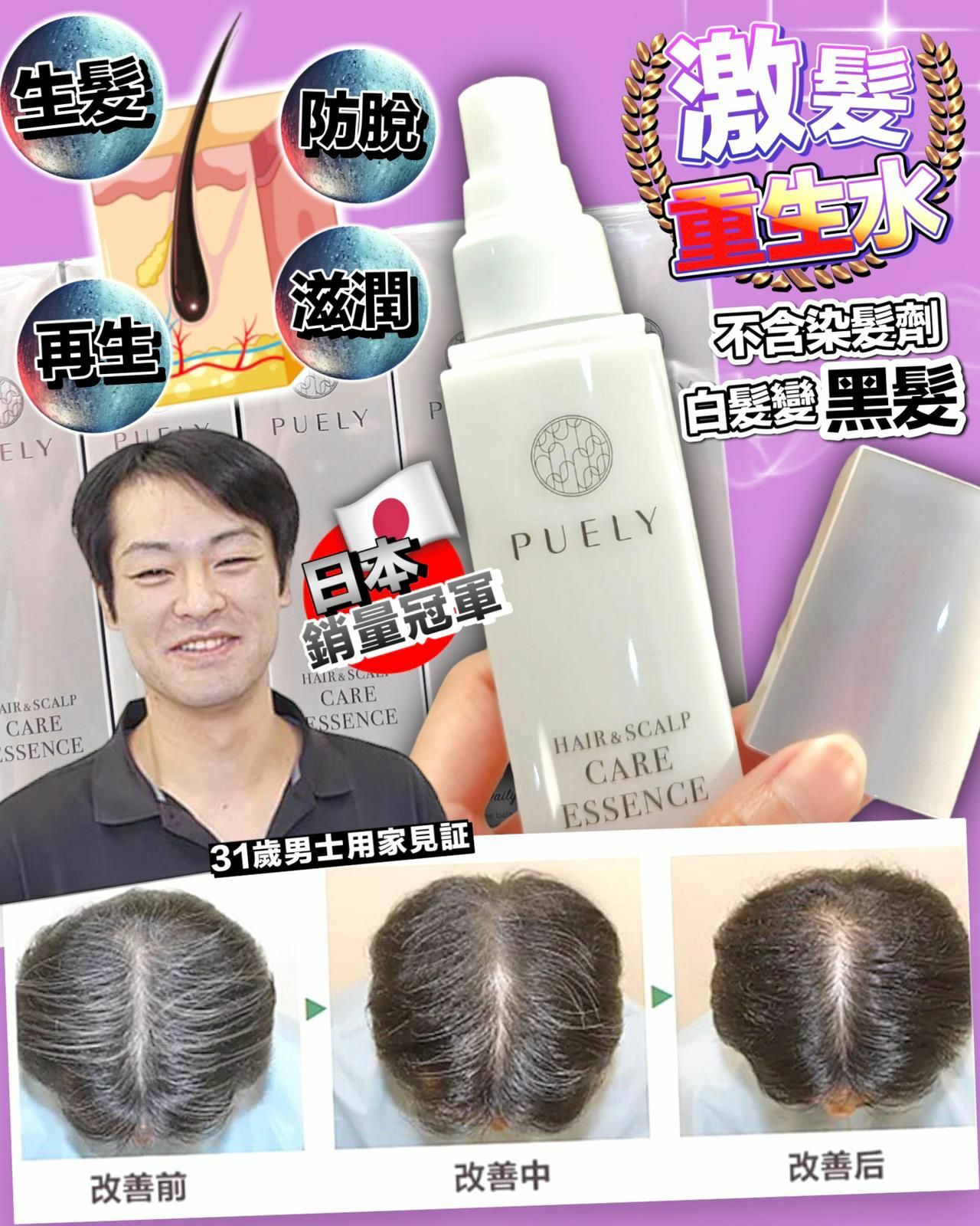 【一口價$298/支】日本Puely 激髮‼️ 重生水 120ml