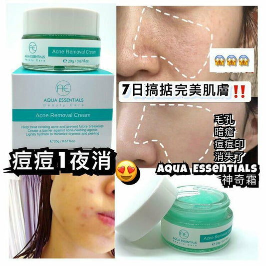 【一口價$211/個】AquaEssentials 水之肌【強力消痘去印神奇霜】