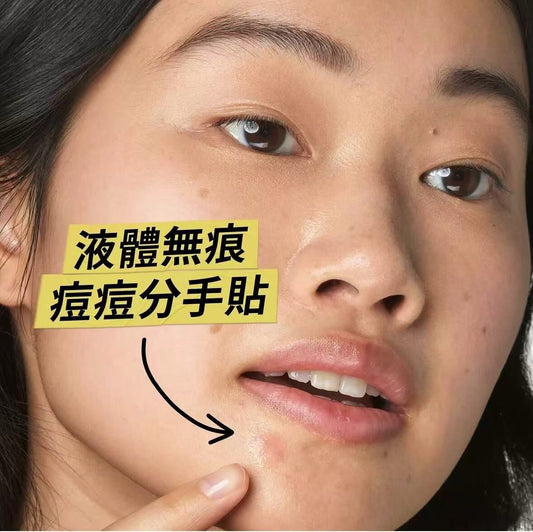 Kiehl's 水楊酸抗粉刺精華液體貼 15ml