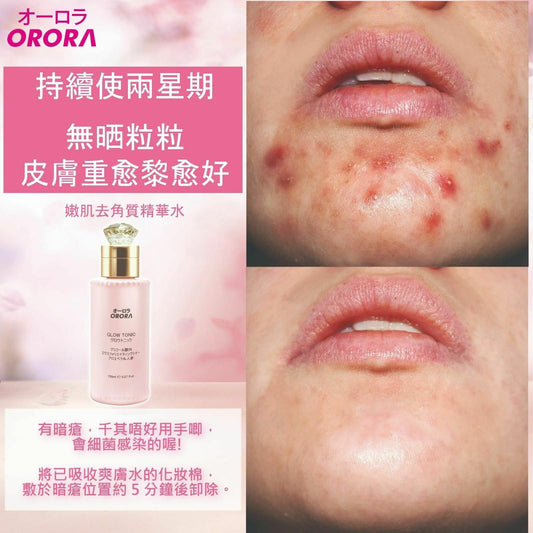 日本🇯🇵ORORA 神仙嫩肌去角質爽膚水150ml