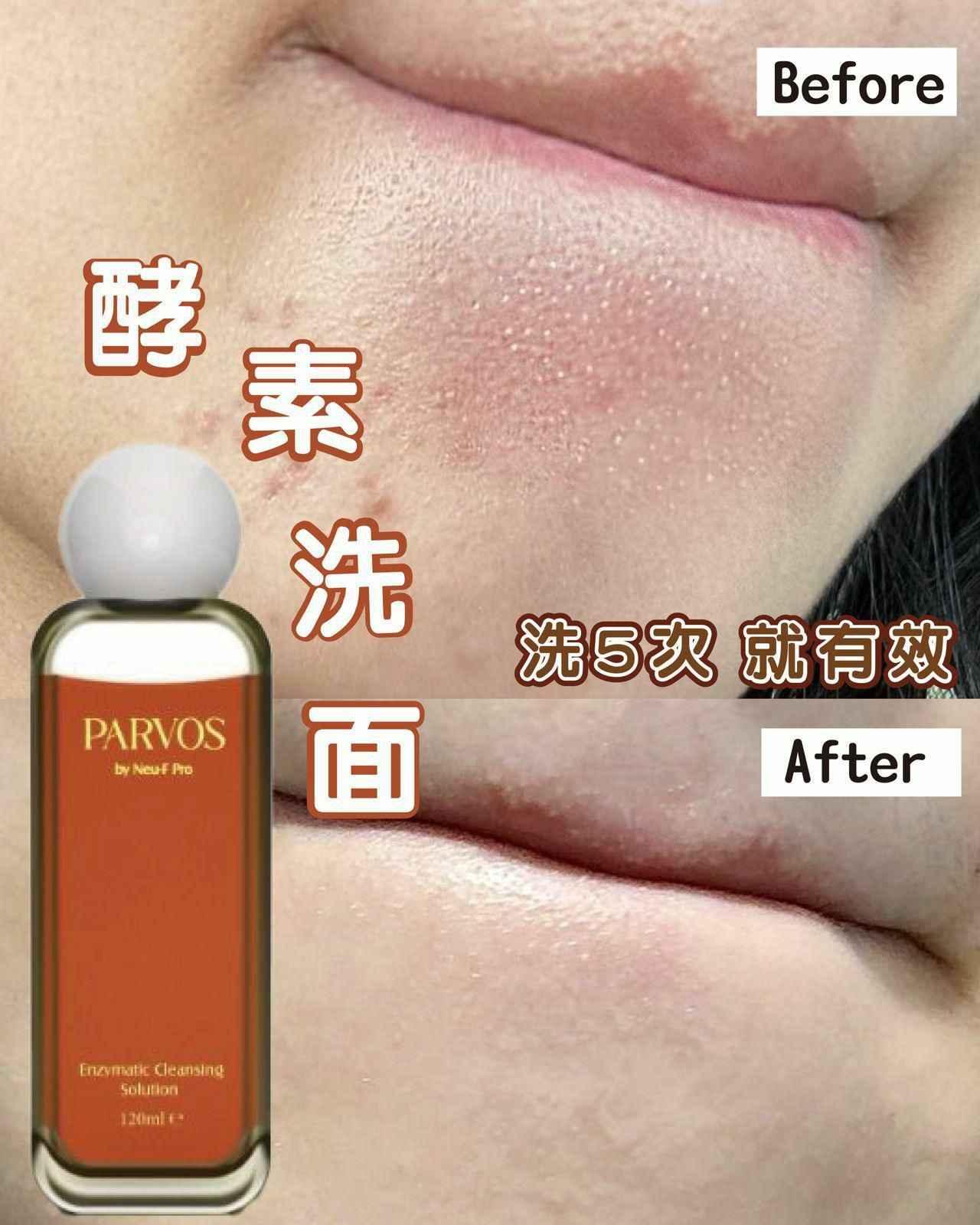 PARVOS 酵素洗面 - HLY &amp; CHOCCICO