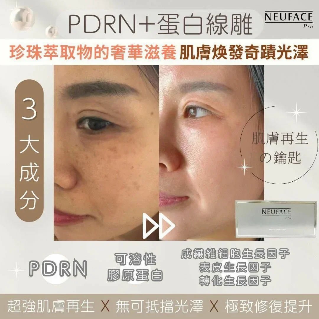 💫 【PDRN+蛋白線雕 - 肌膚奇蹟重生的秘密】 - HLY &amp; CHOCCICO