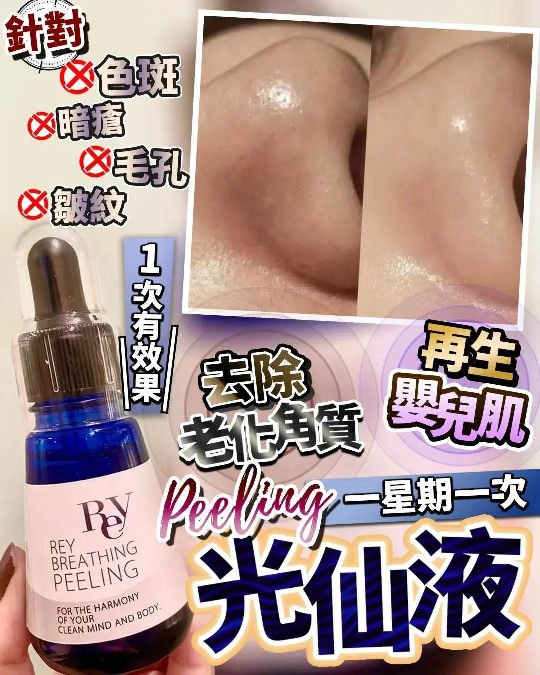 日本美容院✨光仙液peeling 30ml - HLY &amp; CHOCCICO