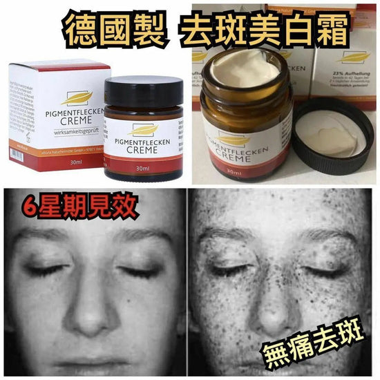 German Pigmentflecken Creme Whitening Cream 30ml