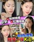 🛢️Pios Supreme Instant Spots Remover 瞬時去痘淨膚精華 10ml🛢️ - HLY & CHOCCICO
