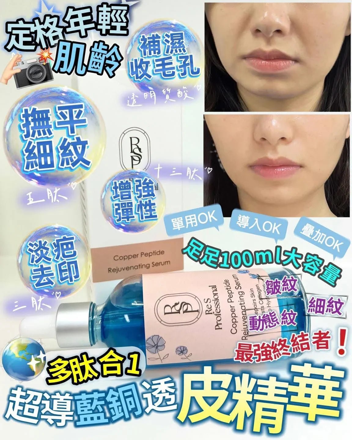 𝑹𝒆 𝑺 𝑷𝒓𝒐超導藍銅透皮精華 - HLY &amp; CHOCCICO