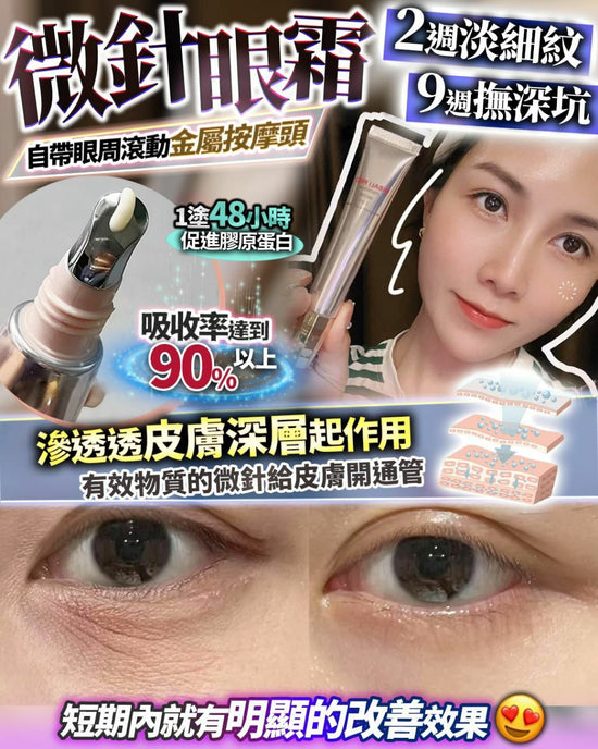 Micro-needle eye 