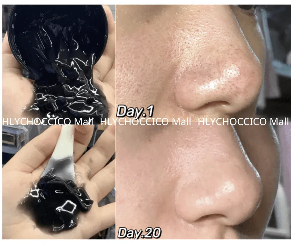 🌟 RNW 黑炭袪黑頭毛孔清潔凍膜 200ml🌟 - HLY &amp; CHOCCICO