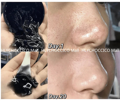 🌟 RNW 黑炭袪黑頭毛孔清潔凍膜 200ml🌟 - HLY &amp; CHOCCICO