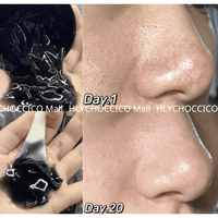 🌟 RNW 黑炭袪黑頭毛孔清潔凍膜 200ml🌟 - HLY & CHOCCICO
