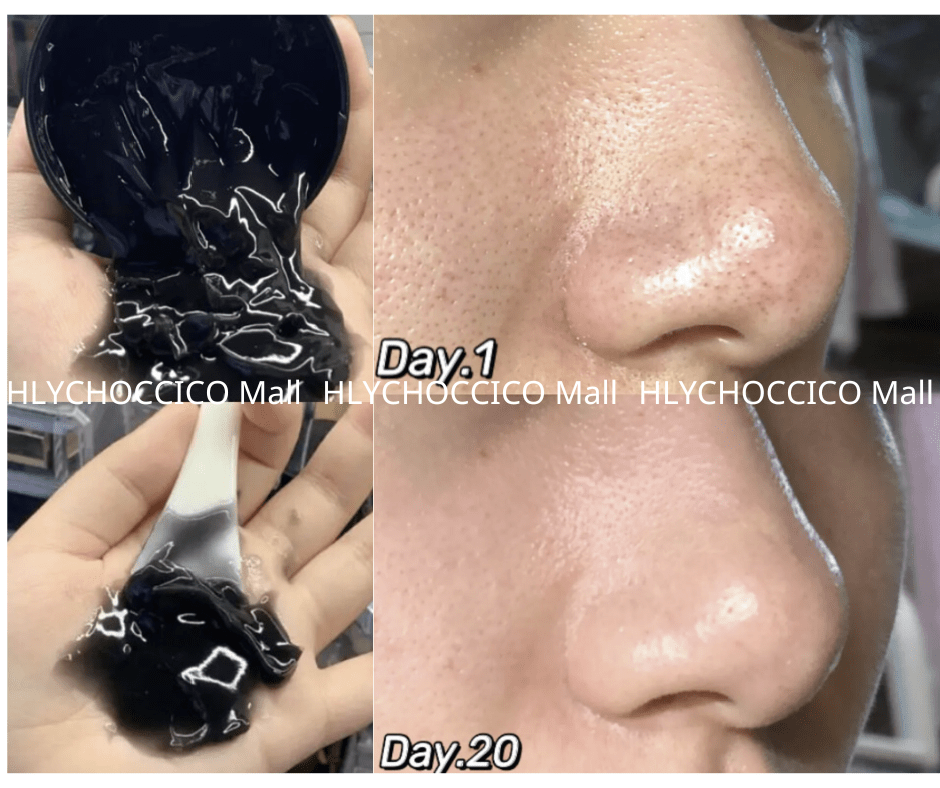 🌟 RNW 黑炭袪黑頭毛孔清潔凍膜 200ml🌟 - HLY & CHOCCICO