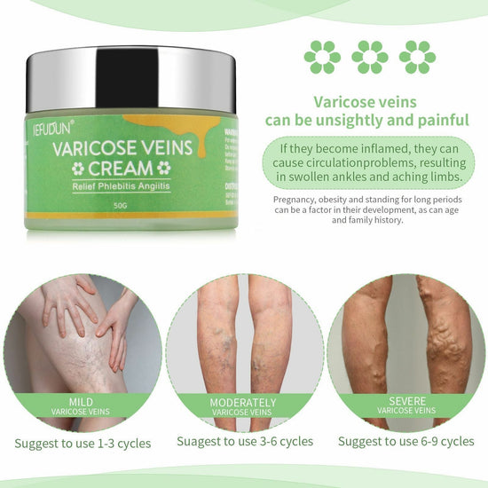 French SEFUDUN natural varicose vein cream 50g