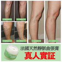 法國SEFUDUN天然靜脈曲張膏50g HLY & CHOCCICO