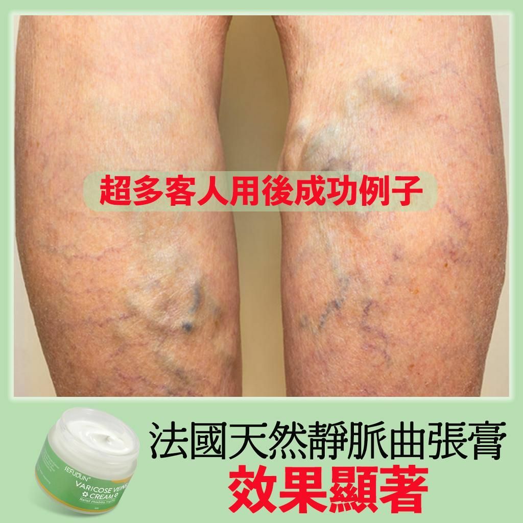 法國SEFUDUN天然靜脈曲張膏50g HLY & CHOCCICO