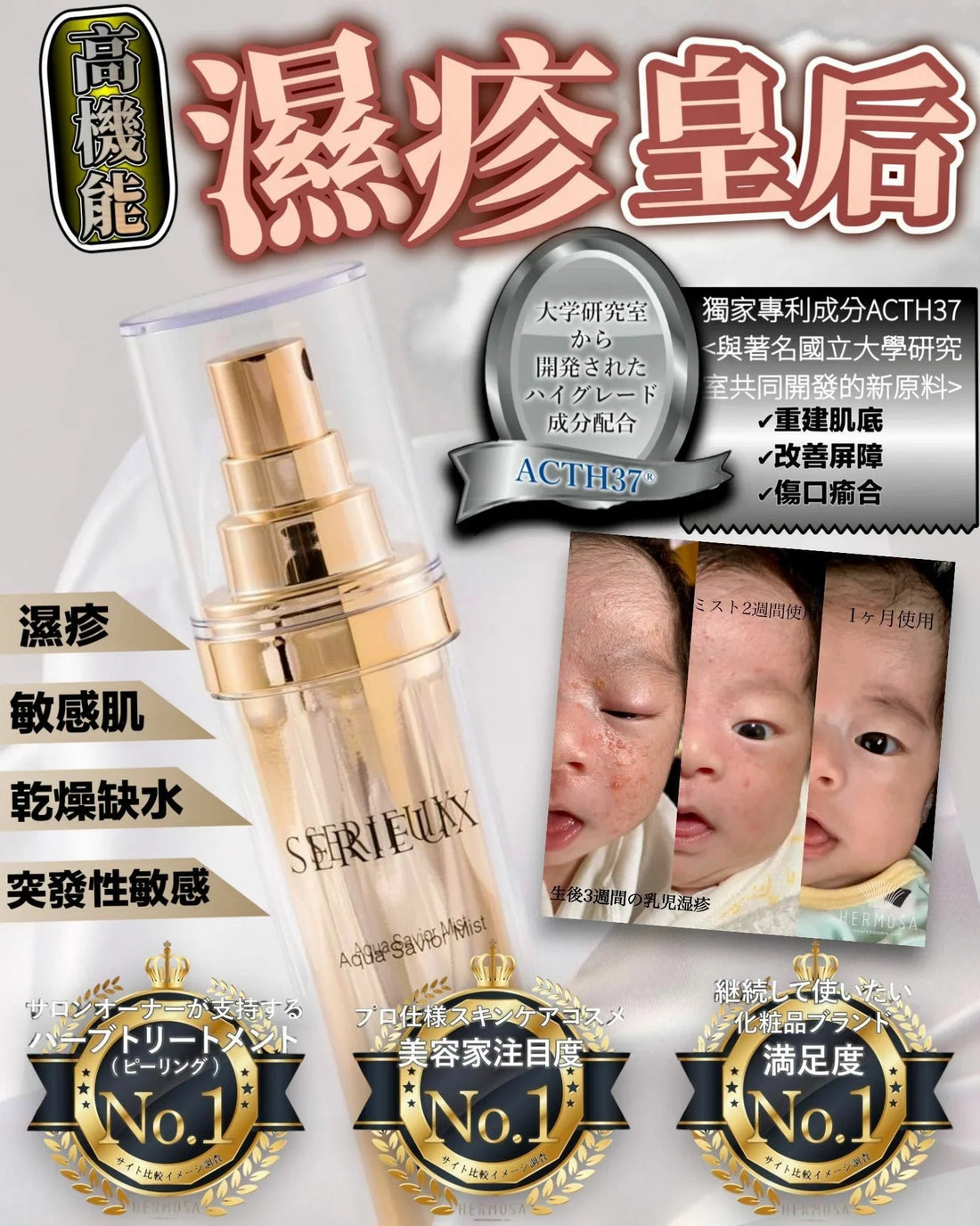 Serieux濕疹皇后 - HLY &amp; CHOCCICO