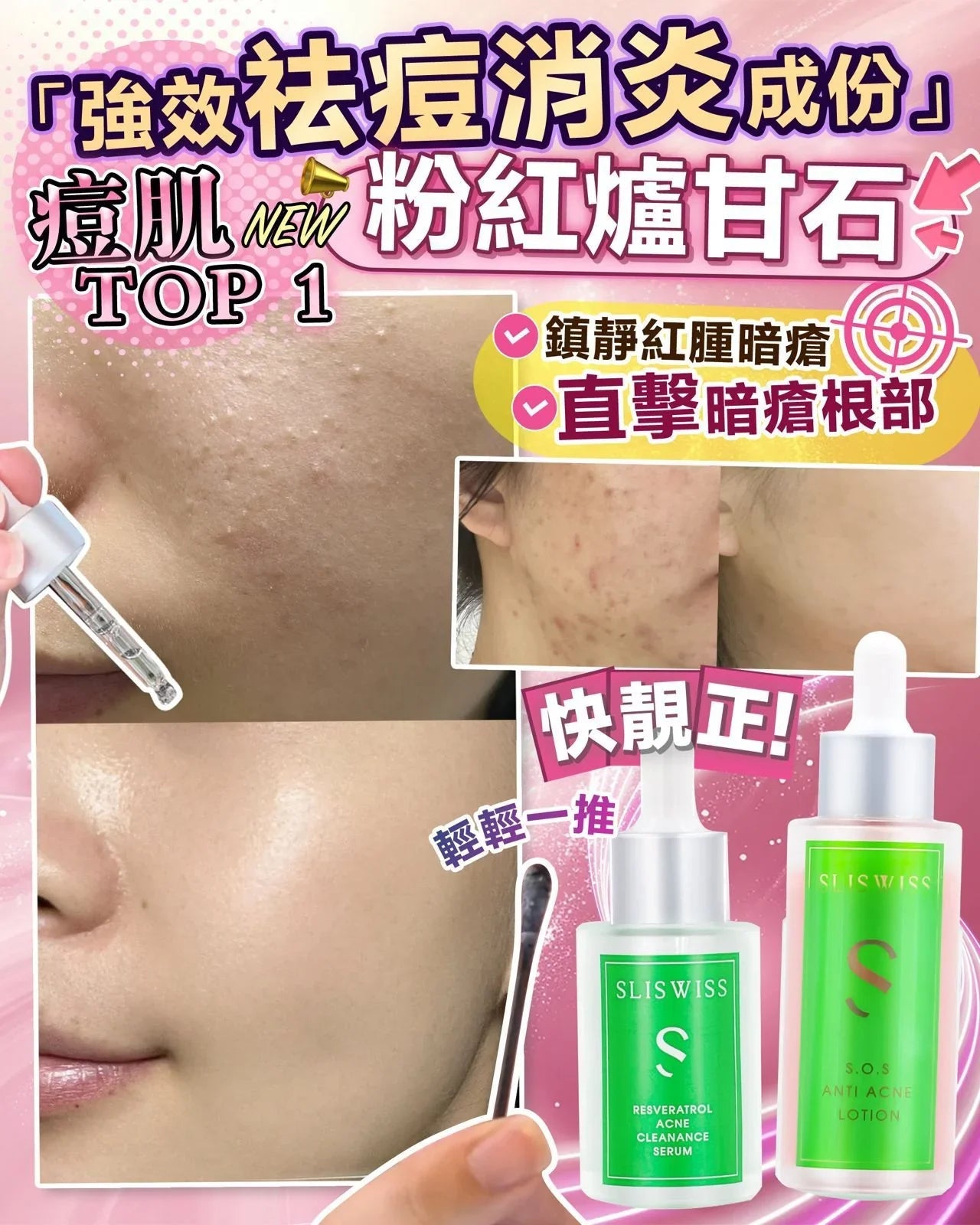 Sliswiss 急救鉗清水／ Sliswiss急救爛面精華（此產品不適用折扣） - HLY &amp; CHOCCICO