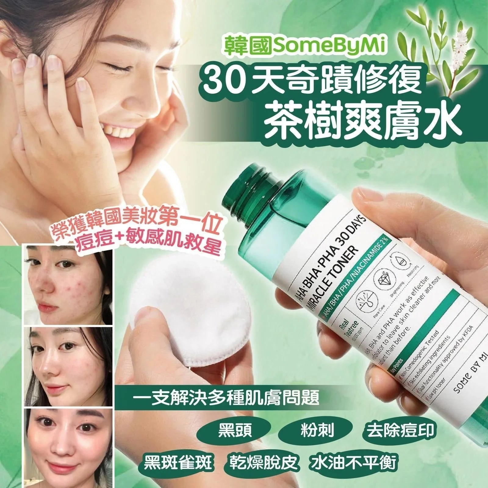韓國 SOME BY MI 30天奇蹟爽膚水 150ml - HLY &amp; CHOCCICO