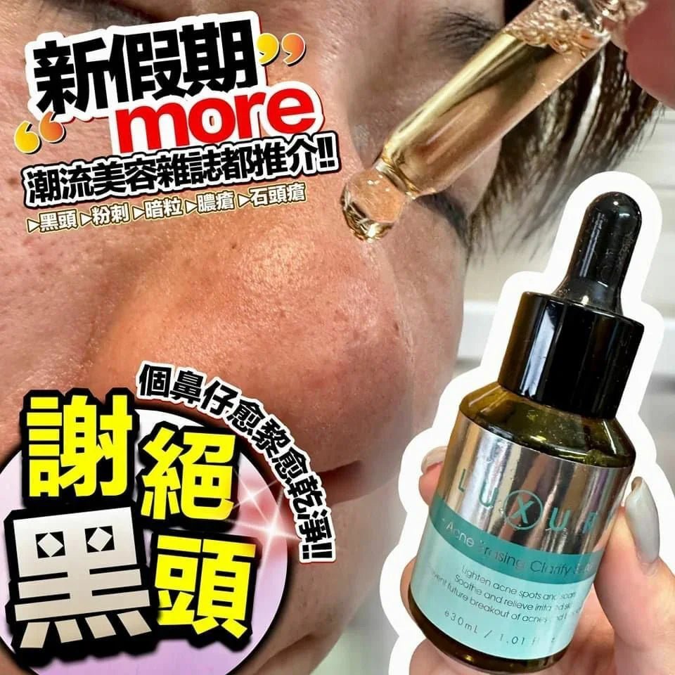 X - Luxury女皇奇蹟粉刺水 30ml - HLY &amp; CHOCCICO