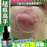 X-Luxury女皇奇蹟粉刺水 30ml - HLY & CHOCCICO