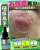 X-Luxury女皇奇蹟粉刺水 30ml - HLY & CHOCCICO
